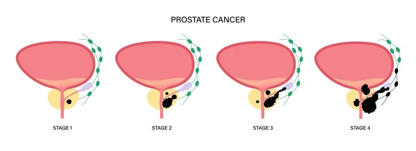 prostaterelax